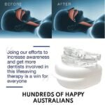 No.1 Anti-Snoring Device - Sleep Apnea Mouth Guard - Image 4